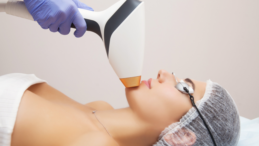 Une femme reçoit un traitement au laser sur son visage.