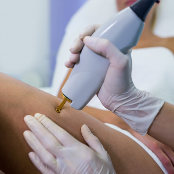 comment-fonctionne-l-appareil-meilleur-laser-epilation-triton